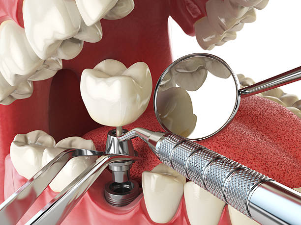 Best Broken Tooth Emergency  in Robinwood, MD